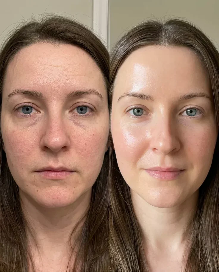 Before and after - Texture and radiance