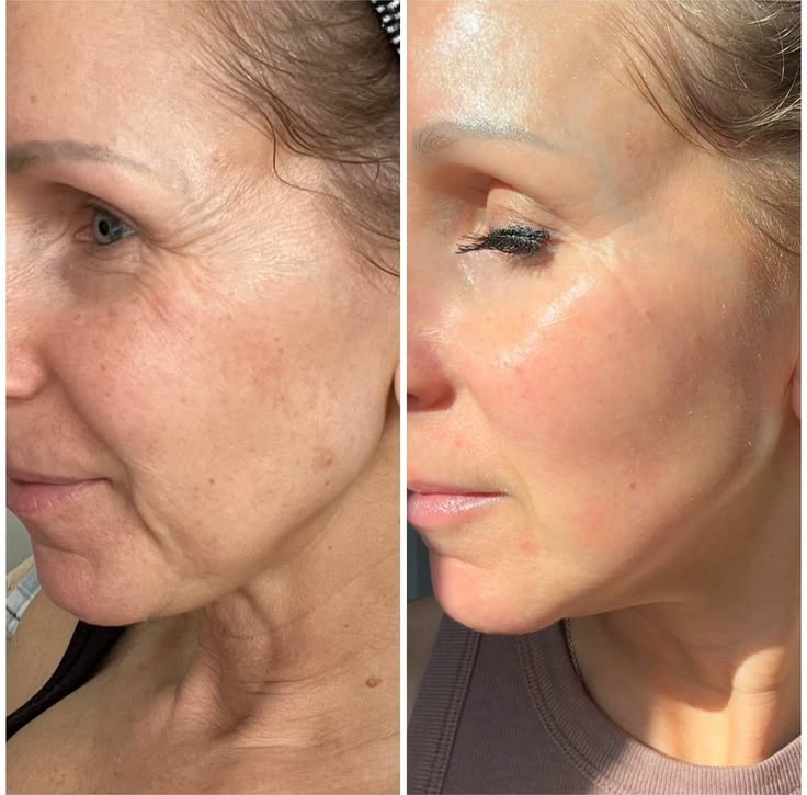 Before and after - Glow and hydration