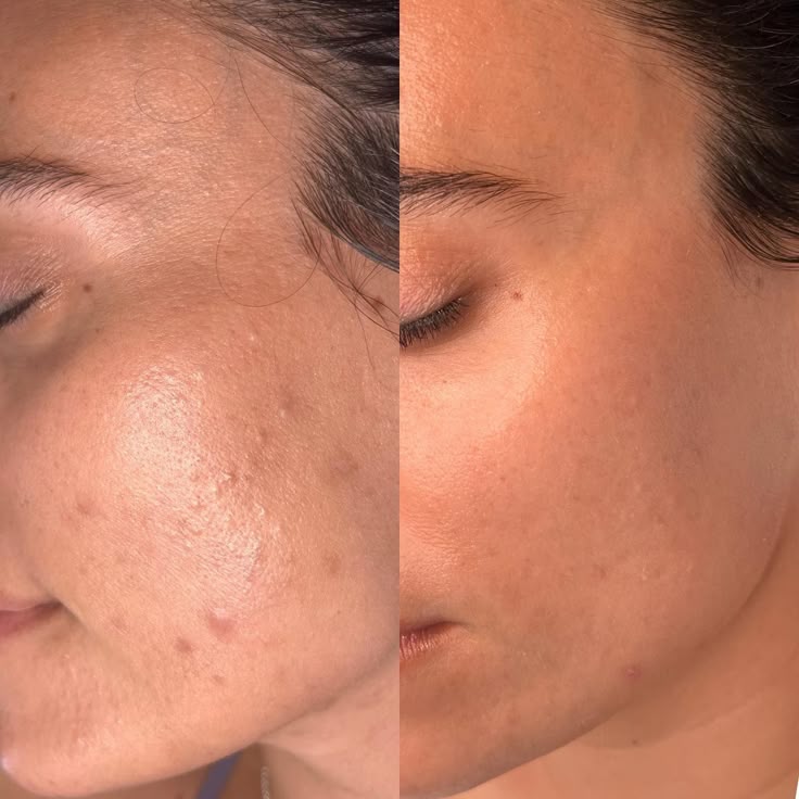 Before and after - Even tone and brighter spots
